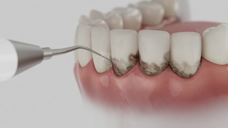 Reliable Tooth Extraction contractor in Security-Widefield, CO by Smile Center Dentistry